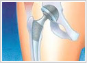 Orthopedic Surgeon delhi
